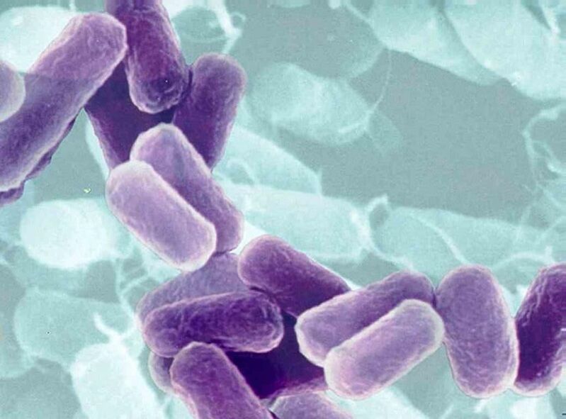 A prostatite causou ingredientes activos en homes con enfermidades de transmisión sexual