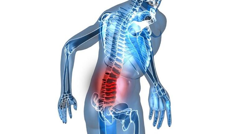Inflamación con prostatite conxestiva