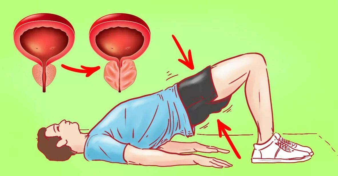 Exercicios contra a prostatite